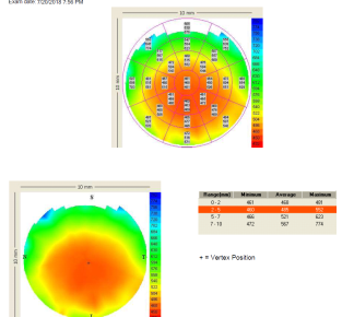 cornea-al-limite-2