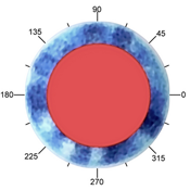 Barrett Toric Calculator