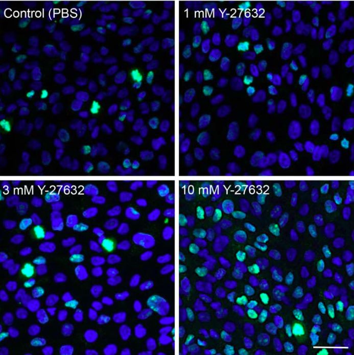 Figura 6: El efecto de la instilación de gotas oculares Y-27632 en la proliferación celular in vivo en un modelo de conejo: Se evaluó el número de células positivas para Ki67 (verdes) entre el endotelio corneal periférico no dañado. Los núcleos celulares se tiñeron de azul con 4'-6-diamidino-2-fenil-indol. Los porcentajes de células positivas para Ki67 en el borde del área herida original se evaluaron mediante microscopía de fluorescencia y el valor medio se representó como un gráfico de barras (n = 6). El porcentaje de células positivas para Ki67 aumentó significativamente en endotelio corneal tratado con 3 o 10 mM de Y-27632. Barra de escala = 100 mm. * P, 0.01, ** P, 0.05. Reimpreso de Okumura et al “the rock inhibitor eye drops accelerate corneal endothelium wound healing” con permiso de la Asociación para la Investigación en Visión y Oftalmología.