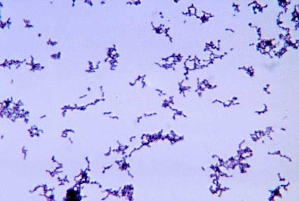 Fig. 1: Propionibacterium acnes cultivado en medio de tioglicolato.