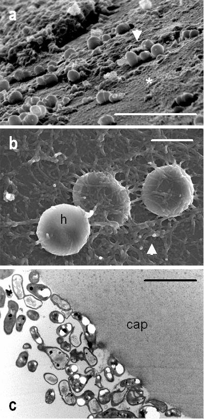 Fig. 6: Análisis de las Endoftalmitis Crónicas mediante Microscopía Electrónica de Barrido (SEM) y de Transmisión (TEM). (a) El análisis mediante SEM de la superficie de una LIO explantada reveló abundante acumulo proteico (asterisco) y la presencia de un biofilm bacteriano de tipo homogéneo regular y de baja adhesividad que estaba constituido por gérmenes con morfología similar a cocos sp (flecha). (b) En otro caso de endoftalmitis crónica la SEM de la superficie de la LIO explantada evidenció la presencia de grupos de hematíes (h) asociada a un biofilm bacteriano de tipo homogéneo regular y de alta adhesividad, constituido por bacterias filamentosas, sugestivas de hifas (flecha). (c) El análisis de los restos capsulares mediante TEM también puede ser de utilidad para el diagnóstico etiológico en las endoftalmitis crónicas. En este caso, se pudo observar colonias de gérmenes con morfología en bastón sugestivos de Propionibacterium acnes adheridos a los restos capsulares (cap). Barra de escala para (a) y (b), 5 &micro;m; para (c), 4&micro;m. (microfotografías cedidas por RP Casaroli-Marano y A Adán)